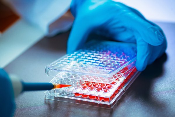 配资网炒股股票 前淘宝总裁押中一个IPO，觅瑞冲刺港股癌症早筛又一股，“前辈”诺辉健康已停牌超1年